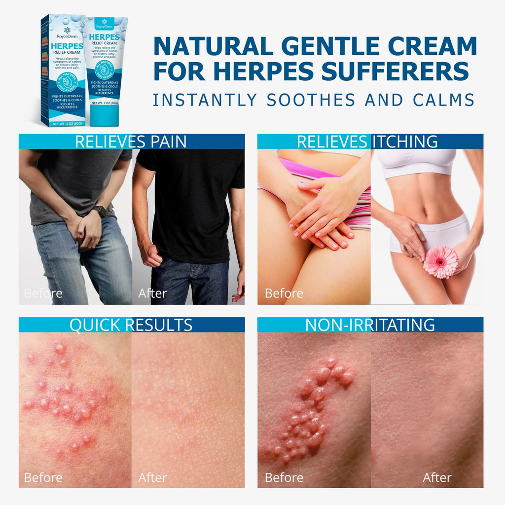 Herpes Cream X97487